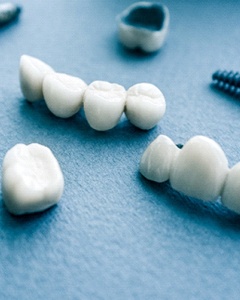 dental crowns, bridges, and implants