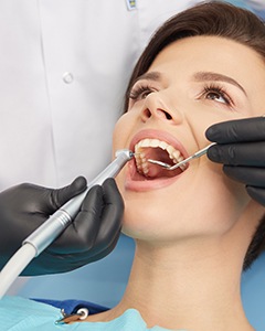 Your dental hygienist will clean and polish your teeth during the cleaning portion of your checkup