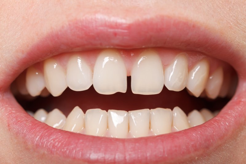 Woman with a gap between her teeth